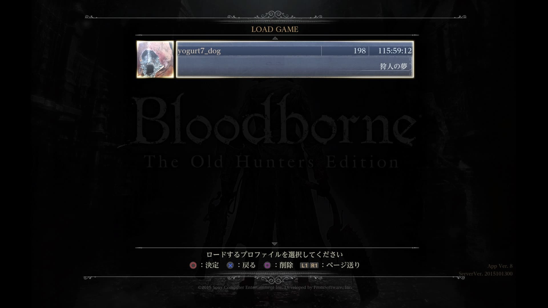 151203_Bloodborne The Old Hunters Edition ロード